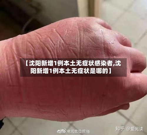 【沈阳新增1例本土无症状感染者,沈阳新增1例本土无症状是哪的】-第2张图片