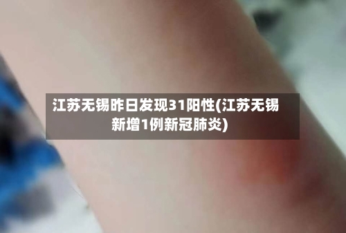江苏无锡昨日发现31阳性(江苏无锡新增1例新冠肺炎)-第2张图片