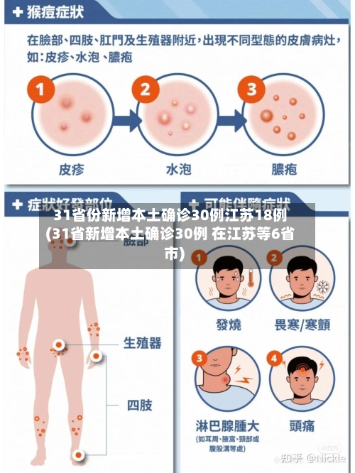 31省份新增本土确诊30例江苏18例(31省新增本土确诊30例 在江苏等6省市)
